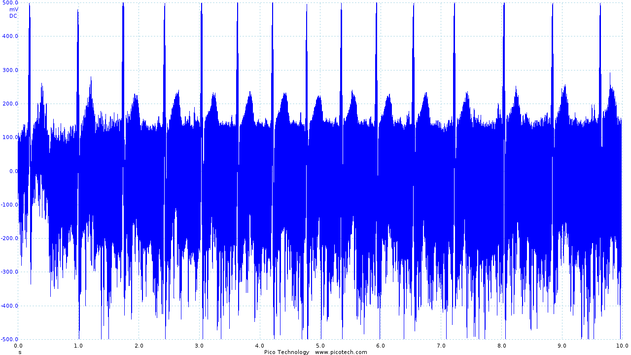 Initial ECG circuit output before filtering